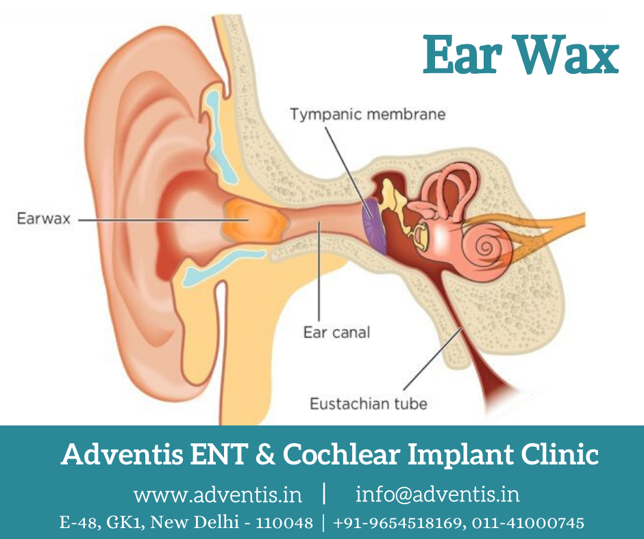 Ear Wax Removal, P Tan Family Medicine Clinic