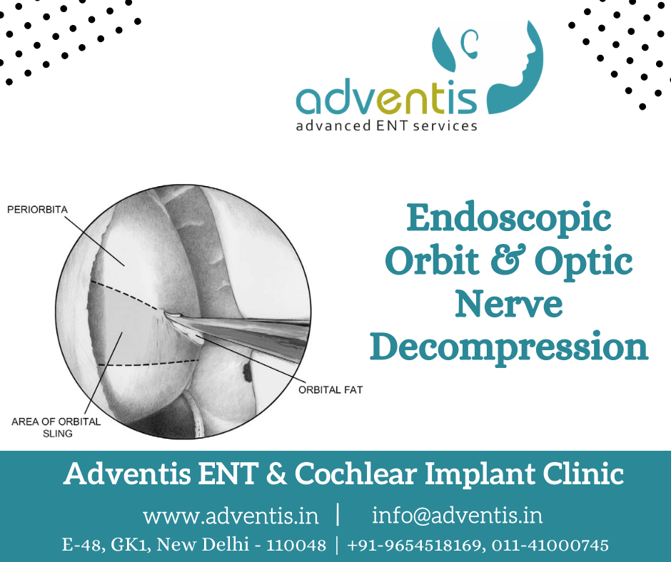 Endoscopic Orbit & Optic Nerve Surgery & Treatment in