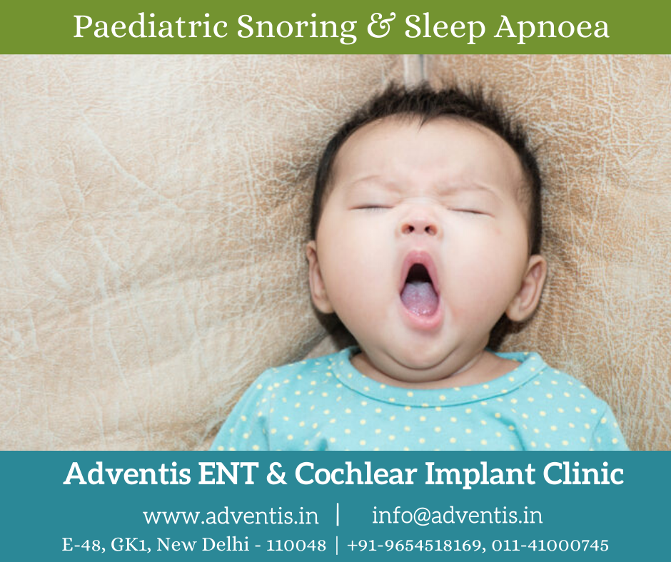 Pediatric Snoring & Sleep Apnoea in DelhiTreatment & Cost Adventis