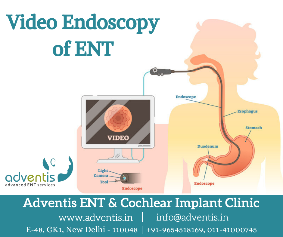 Video Endoscopy of Ear, Nose, Throat, Larynx & Airway Adventis