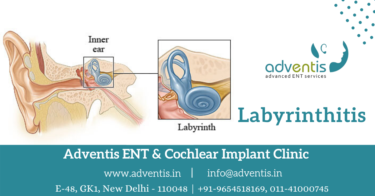 Labyrinthitis Symptoms, Causes, Diagnosis, treatment in Dellhi Adventis