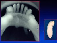 Submand Duct Calculus