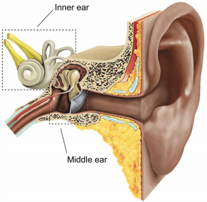 stapedectomy